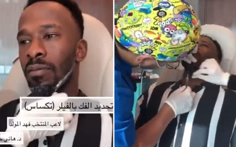 لن تصدقوا كيف أصبح شكله.. اللاعب السعودي ” فهد المولد ” أجرا عملية “تكساس” الشهيرة ليصبح وسيم وجذاب لكن النتيجة كانت مفاجئة وغير متوقعة!! شاهد الفيديو