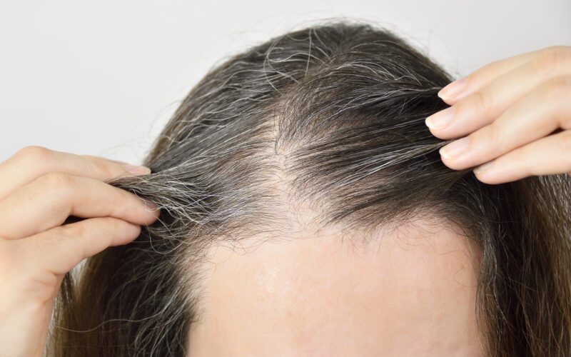 “خميرة الخبز” الحل السحري لعلاج تساقط الشعر في وقت قصير.. تعرف الطريقة الصحيحة للاستخدام