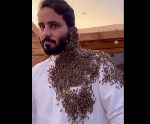 شاهد.. سعودي يوثق تجمّع ١٥ ألف نحلة على وجهه.. والنهاية لا تحمد عقباه