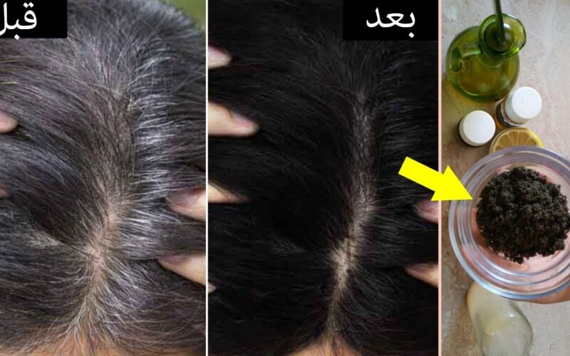 إليك الخطوات الصحيحة للقضاء على الشعر الأبيض نهائياً عن طريق القرنفل وزيت السمسم.. طريقة التحضير