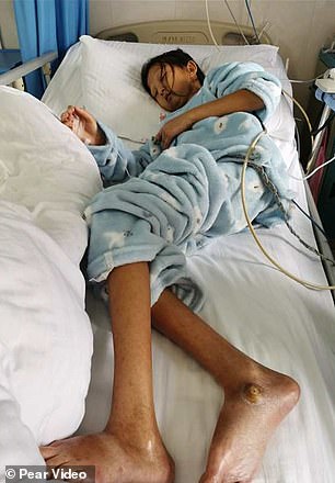 القصة كاملة التي هزت السعودية والعالم للطالبة التي جوعت نفسها 5 سنوات لتطعم شقيقها المريض!